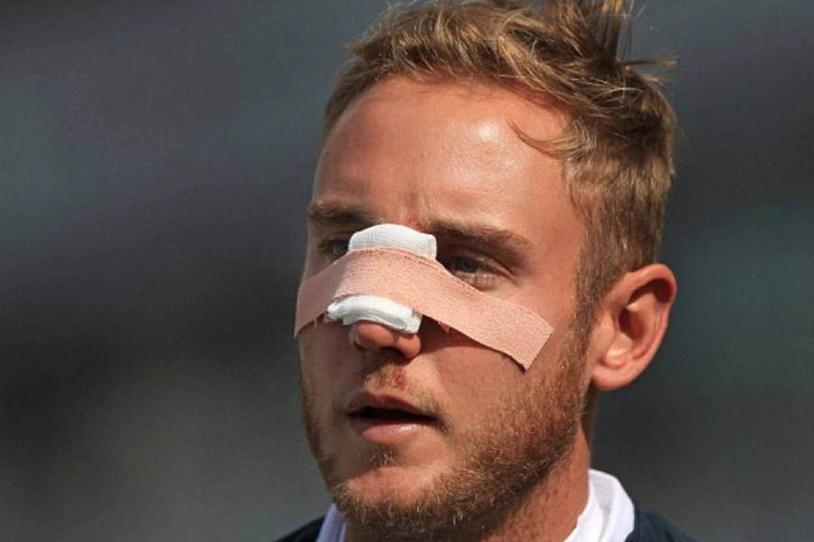 دیه شکستگی غضروف بینی