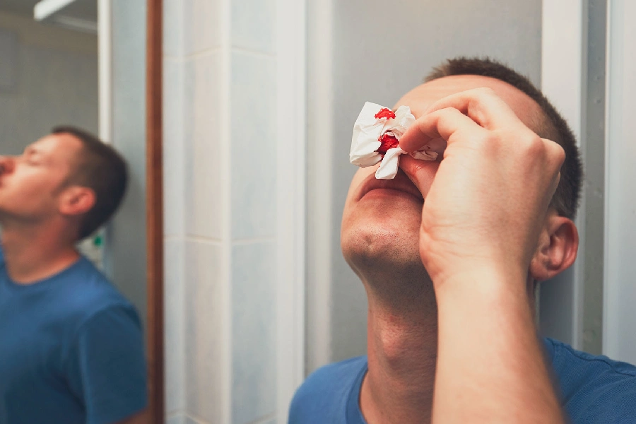 مجازات شکستن بینی در دعوا